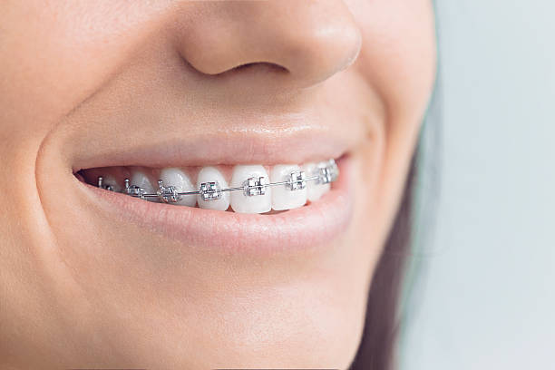 Best Teeth Whitening  in Jeffersonville, IN